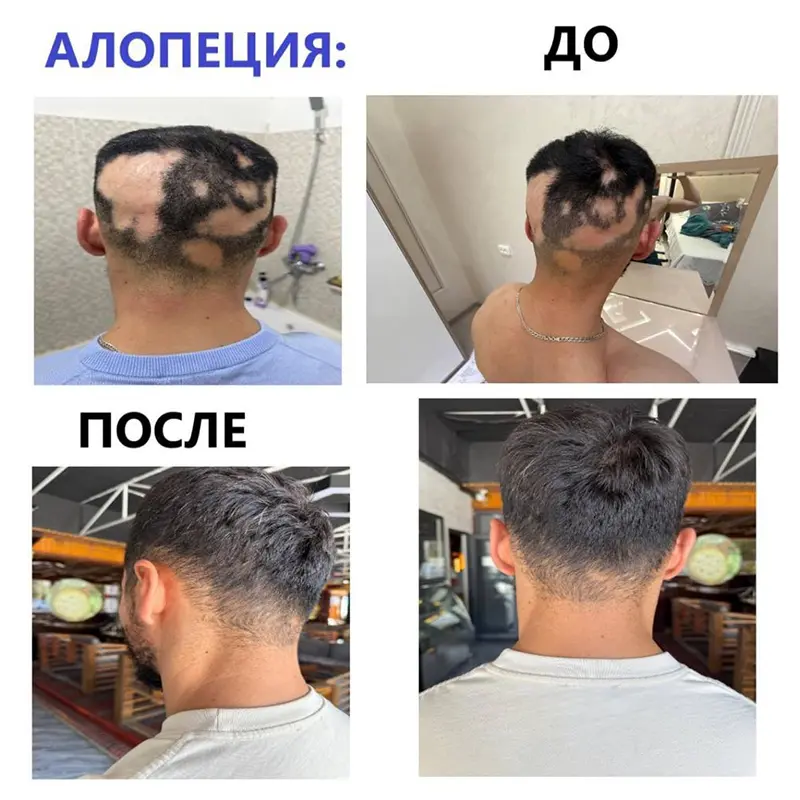 Активатор клеток - изображение 2